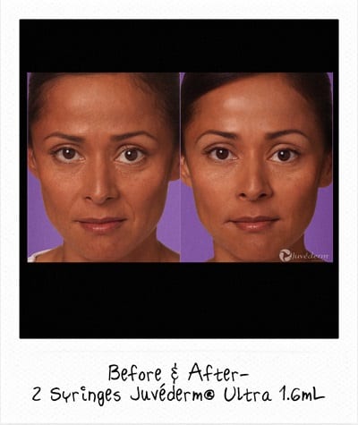 Facial Plastic Surgery Services on a woman
